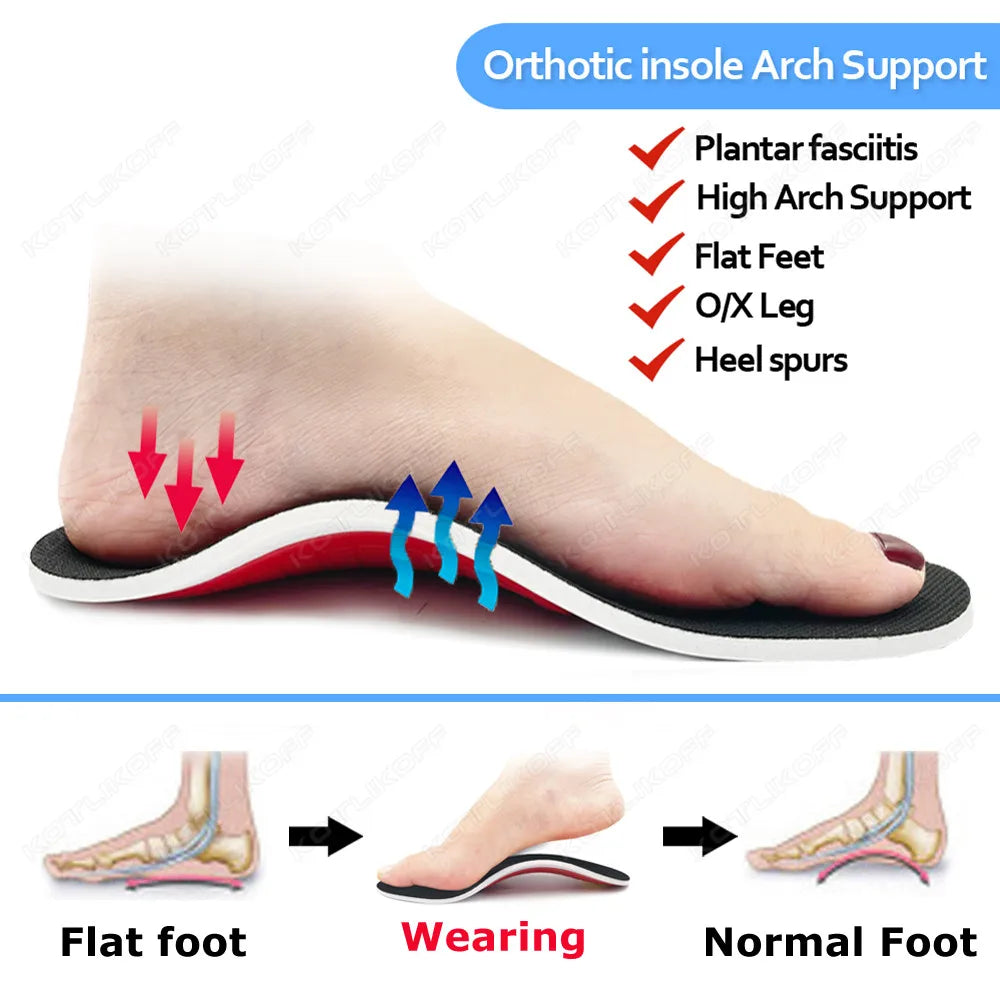 3D Arch Support Insoles